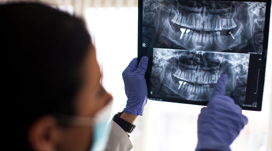 a person is looking at an x ray of their teeth a person is looking at an x ray of their teeth