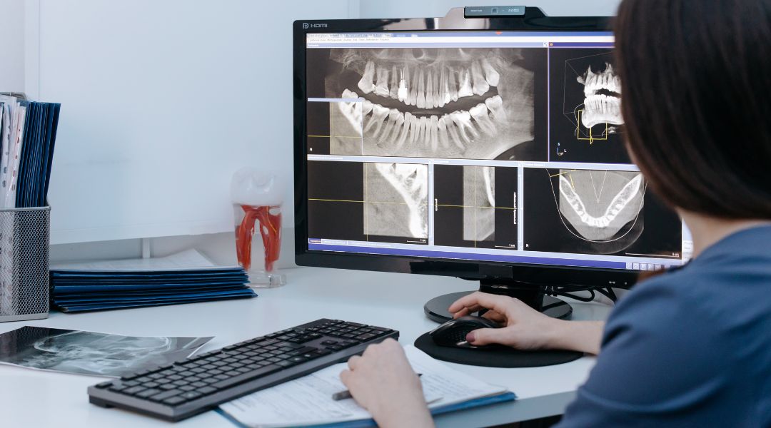 dental xray dental xray